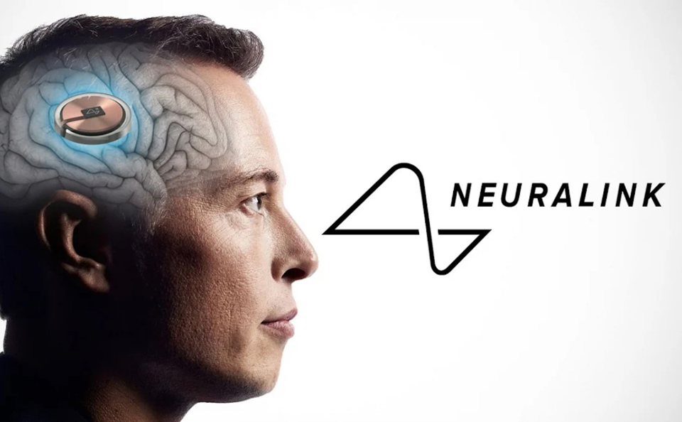 Canada cho ph&eacute;p Neuralink của tỷ ph&uacute; Elon Musk thử nghiệm cấy chip v&agrave;o n&atilde;o người.