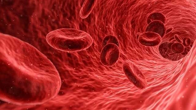 1-thalassemia 1-thalassemia.jpg